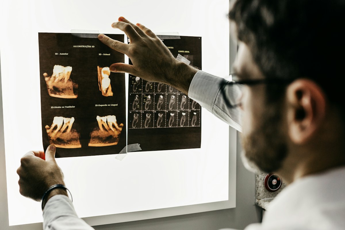 Dentista analisando exames de imagem para planejamento de implante